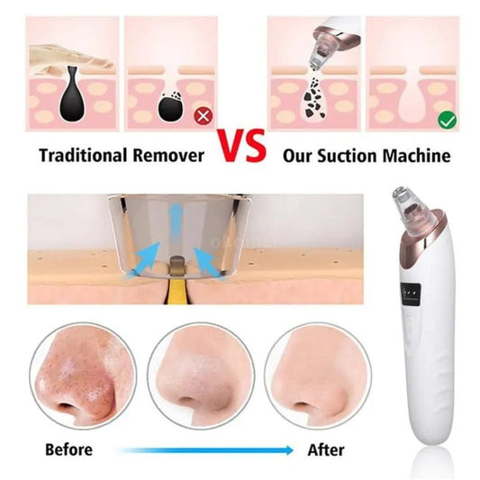Face Vacuum Suction Blackhead Remover Pore Cleaner Electric Deep Cleansing Tool